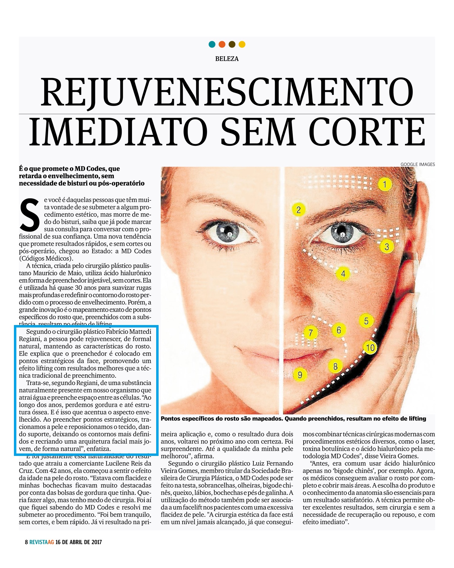 Rejuvenescimento imediato sem cortes